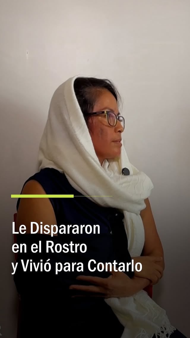 Jasith Sangama jamás imaginó que habían puesto precio a su vida cuando acompañó a su hija al autobús escolar el pasado marzo. Al salir de su condominio, un sicario ya la esperaba. Al percatarse del peligro, corrió para refugiarse en su vivienda, pero el atacante logró dispararle en pleno rostro. Milagrosamente, Jasith sobrevivió al brutal atentado, pese a que la bala atravesó su cráneo.

Gracias a las cámaras de seguridad que captaron el ataque, las autoridades lograron detener al presunto sicario, quien confesó ser el autor material de este aterrador crimen.

#primerimpacto #historiasdeimpacto #peru #milagro